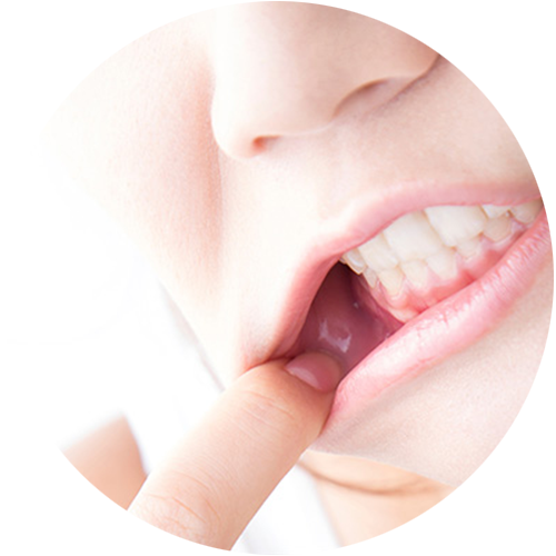 歯茎から出血する・口臭が気になる